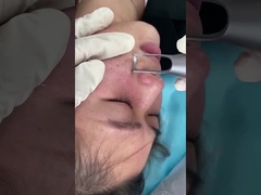 машина лазера пикосекунды салона 1064nm 532nm для обработки проблемы убытоков пигментацией кожи