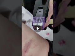 50 Вт фракционная микроигла с радиочастотным питанием от 100 В до 240 В