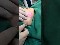 Профессиональная 1470nm диодная лазерная машина для уменьшения жира Видимые результаты за 2-3 сеанса