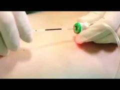 Лазерная липолизная машина